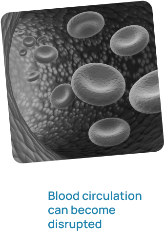 Blood circulation can become disrupted