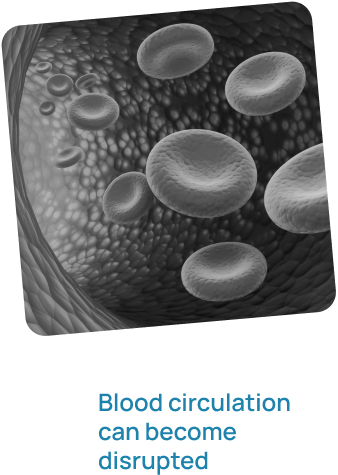 Blood circulation can become disrupted